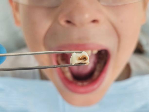 Best Pediatric Emergency Dentist in Goodwater, AL